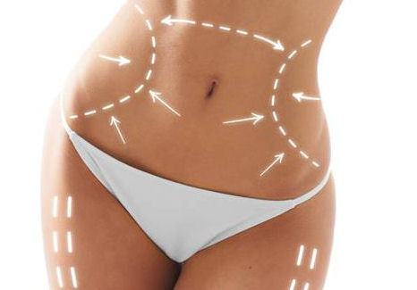 Como perder gordura localizada 1 Como perder gordura localizada 1